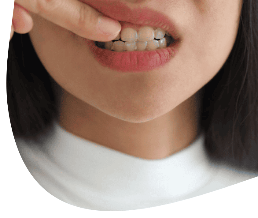 Žena ukazuje svoje rovné zuby.