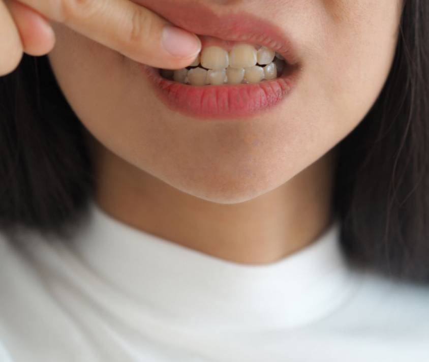 Žena si prstom stláča zuby